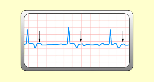 graphic file with name 6376_9_De_48_Fig15_HTML.jpg