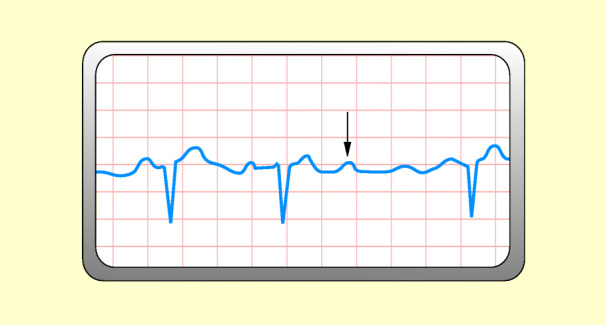 graphic file with name 6376_9_De_48_Fig14_HTML.jpg