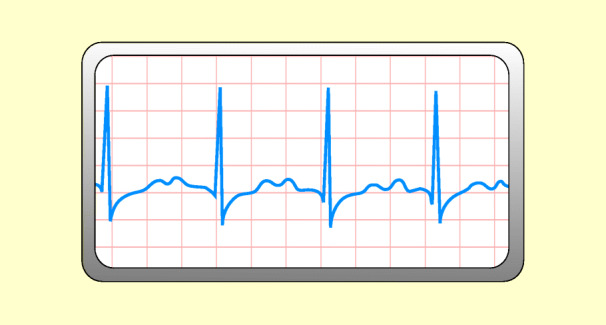 graphic file with name 6376_9_De_48_Fig13_HTML.jpg