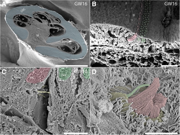 Fig. 11