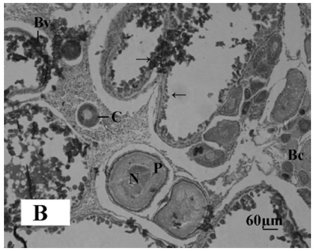 Microphotograph 1B