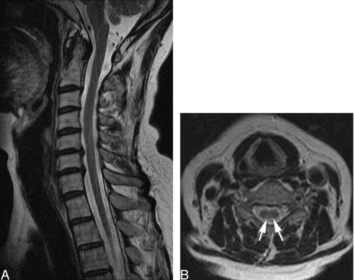 Fig 2.