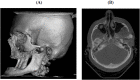 Fig. (2)