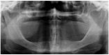 Fig. (5)