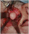Fig. (3)
