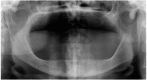 Fig. (1)