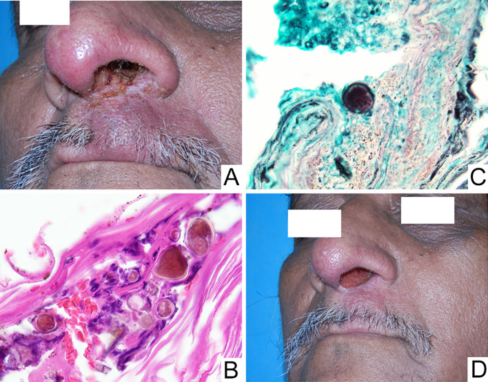 Fig. 4