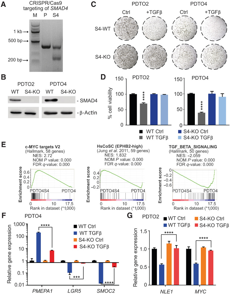 Figure 1. Effect of SMAD4 ablation in colorectal cancer organoids on tumor growth and gene expression. A, Mutation detection assay on genomic DNA obtained from PDTO cells edited via CRISPR/Cas9 to achieve SMAD4 KO (S4) or on a SMAD4 wild-type parental control (P). M, Marker. B, Immunoblot analysis of SMAD4 protein levels in parental SMAD4 wild-type (WT) and CRISPR/Cas9-targeted (S4-KO) PDTO lines 2 and 4. β-Actin served as a loading control. C, Enhanced focal images of 50 μL Matrigel droplets containing SMAD4 wild-type (S4-WT) or SMAD4 knockout (S4-KO) organoid lines maintained in tumor organoid culture (TOC) medium with (+TGFβ) or without (Ctrl) 20 nmol/L recombinant TGFβ1 for 7 (PDTO2) or 10 (PDTO4) days. D, ATP content measurement–based cell viability assessment (CellTiter-Glo 3D) of SMAD4 wild-type (WT) and SMAD4 knockout (S4-KO) PDTO lines maintained in TOC medium (Ctrl) or TOC medium supplemented with 20 nmol/L recombinant TGFβ1 for 7 (PDTO2) or 10 (PDTO4) days. Statistical significance between all samples was assessed by one-way ANOVA plus Tukey multiple comparisons test and is indicated by asterisks (****, P ≤ 0.0001). Shown is the mean ± SD (n = 4). E, GSEA on gene signatures derived from RNA-sequencing data generated from SMAD4 knockout versus SMAD4 wild-type colorectal cancer organoids (PDTO4S4 vs. PDTO4) maintained in TGFβ1-containing TOC medium. Shown are enrichments of the gene sets c-MYC targets V2, TGFβ signaling (MSigDB Collections, Broad Institute) and EPBH2high human colonic stem cells (HsCoSC, Jung et al., 2011). NES, normalized enrichment score; NOM P value, nominal P value; FDR-q, false discovery rate q-value. F, qRT-PCR analysis of LGR5, SMOC2, and PMEPA1 gene expression in SMAD4 wild-type (WT) and SMAD4 knockout (S4-KO) PDTO lines maintained in TOC medium (Ctrl) or TOC medium supplemented with 20 nmol/L recombinant TGFβ1 (TGFβ) for 72 hours. G, qRT-PCR analysis of NLE1 and c-MYC gene expression in SMAD4 wild-type (WT) and SMAD4 knockout (S4-KO) PDTO lines maintained in TOC medium (Ctrl) or TOC medium supplemented with 20 nmol/L recombinant TGFβ1 (TGFβ) for 72 hours. Statistical significance between all samples in F and G was assessed by ordinary two-way ANOVA plus Tukey multiple comparison test and is indicated by asterisks (***, P <0.001; ****, P ≤ 0.0001) for the PDTOS4 versus PDTO comparison in the presence of TGFβ1. Shown is the mean ± SD (n = 3).