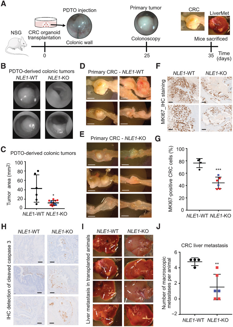 Figure 6. NLE1 ablation reduces colorectal cancer primary tumor formation and liver metastasis in vivo. A, Schematic representation of endoscopy-guided PDTO orthotopic transplantation, colonoscopy follow-up and organ analysis of sacrificed immunodeficient (NSG) mice. At time point t = 0, the process of PDTO needle injection, as seen via the endoscope camera, is depicted while the injection bubble is about to form. Control endoscopy was performed at day 25 to control for primary tumor occurrence and size and to estimate the end point of the experiment when animals need to be sacrificed due to excessive tumor burden. Mice were sacrificed 35 days after orthotopic PDTO transplantation, colonic tumors were documented, and the liver was scrutinized for occurrence of macroscopically visible metastatic foci. B, Colonoscopy of immunodeficient mice was performed 3.5 weeks after orthotopic transplantation of NLE1 wild-type (WT) or NLE1 knockout (KO) colorectal cancer organoids into the colonic wall. Note the more pronounced protrusion of NLE1-WT tumors into the colonic lumen when compared to tumors grown from NLE1-KO PDTOs. C, Scatter plot showing the areas of primary tumors grown in the colon of xenotransplanted mice. Four mice (n = 6 primary tumors) had been transplanted with NLE1 wild-type (WT) colorectal cancer organoids and 6 mice (n = 12 primary tumors) had been transplanted with NLE1 knockout (KO, NLE1-targeting guide RNAs 1 (red dots) or 2 (blue dots) colorectal cancer organoids. All mice were sacrificed for analysis 5 weeks after xenotransplantation. Statistical significance between the NLE1-WT and NLE1-KO groups was assessed by an unpaired t test with Welch correction to account for the observed unequal SDs within the two experimental groups and is indicated by asterisks (*, P < 0.05). Shown is the mean ± SD. D, Macroscopic images of primary tumors formed in the colon of four mice orthotopically transplanted with 150 tumor organoids wild-type (WT) for NLE1 per injection site. All mice were sacrificed for analysis 5 weeks after xenotransplantation. Scale bars, 0.5 cm. E, Macroscopic images of primary tumors formed in the colon of six mice orthotopically transplanted with 150 tumor organoids knockout for NLE1 per injection site. All mice were sacrificed for analysis 5 weeks after xenotransplantation. Scale bars, 0.5 cm. F, Representative microscopy images of IHC staining of the proliferation marker MKI67 on FFPE tissue sections prepared from NLE1 wild-type (WT) and NLE1 knockout (KO) PDTO-derived primary tumors. Scale bars, 100 μm. G, Quantification of MKI67-positive tumor cells (in %) in FFPE tissue sections from NLE1 wild-type (WT, n = 4) and NLE1 knockout (KO, n = 6) primary tumors. An unpaired t test was performed to assess significance (***, P < 0.001). Shown is the mean ± SD. H, Representative microscopy images of IHC staining of the apoptosis marker cleaved caspase 3 on FFPE tissue sections prepared from NLE1 wild-type (WT) and NLE1 knockout (KO) primary tumors. Scale bars, 100 μm. I, Exemplary macroscopic images of resected livers and colorectal cancer-derived liver metastases formed in mice orthotopically transplanted with NLE1 wild-type (WT) or NLE1 knockout (KO) tumor organoids. Arrows indicate macroscopically visible liver metastasis. J, Scatter plots showing the quantification of macroscopic metastatic foci detected in the liver of mice five weeks after endoscope-guided, orthotopic transplantation of colorectal cancer organoids either wild-type (WT) or knockout [KO, NLE1-targeting guide RNAs 1 (red squares) or 2 (black squared)] for NLE1. Statistical significance between the NLE1-WT and NLE1-KO groups was assessed by an unpaired t test with Welch correction to account for the observed unequal SDs within the two experimental groups and is indicated by asterisks (**, P < 0.01). Shown is the mean ± SD.