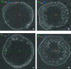 FIG. 2.