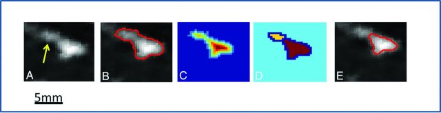 Fig 3.