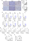 Figure 3. Administration of Delta-24-ACT results in immune cell infiltration and the production of proinflammatory cytokines. Osteosarcoma tumors were generated by intratibial injection of K7M2 cells, and PBS, Delta-24-RGD, or Delta-24-ACT was administered intratumorally 10 days after cell implantation. Animals were sacrificed on day 17 after cell implantation. A, Representative images (scale bar, 100 μm) of CD3 and CD8 immunostaining in osteosarcoma tumors from control mice or virus-treated mice. B, Quantification of CD3+ and CD8+ cell infiltration per mm2 in osteosarcoma tumors (n = 6–8). P values were calculated using two-tailed Student t test. C, Flow cytometric analysis of immune cell populations within the TIL population in the tibias of mice bearing intratibial K7M2 tumors and treated with Delta-24-RGD or Delta-24-ACT. The bars indicate the mean ± SD values (N = 4/5). D, Flow cytometric analysis of immune cell populations within the TIL population in the tibias of mice bearing intratibial K7M2 tumors and treated with Delta-24-ACT. The bars indicate the mean ± SD values (N = 3); Mann–Whitney test. E, Quantification of IFNγ production by ELISA after 72 hours of coculture of K7M2 cells with splenocytes isolated from mice treated with PBS or the different viruses. The data are presented as the median ± SD values (n = 5). One-way ANOVA test was used for comparison between control and treated mice. F, Quantification of IFNγ spot-forming cells per 4 × 104 splenocytes isolated from control and Delta-ACT–treated animals and cocultured with tumor cells. P values were calculated using one-way ANOVA.