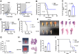 Figure 5. Administration of Delta-24-ACT results in local and metastatic efficacy effect in a murine osteosarcoma model. A, Analyses of tumor burden development in the PBS-treated (control group) and Delta-24-ACT–treated groups. Tumor volume in mouse tibias was measured on different days until the end of the experiment. B, Survival curves. The graphs show the overall survival of mice treated with Delta-24-ACT (blue line) or PBS (black line). C, Evaluation of lung metastasis using micro-CT. Quantification of the normal lung parenchyma using micro-CT. D, The long-term survivors from the Delta-24-ACT–treated group were subjected to rechallenge with K7M2 cells in the contralateral tibia and compared with control untreated mice (naïve). Analyses of tumor burden development in the naïve-treated (control group) and Delta-24-ACT–treated groups. Tumor volume in mouse tibias was measured on different days until the end of the experiment. E, Kaplan–Meier survival curves of the long-term survivors from the Delta-24-ACT–treated group subjected to a rechallenge with K7M2 cells in the contralateral tibia and compared with control untreated mice. F, Representative macroscopic images and H&E-stained sections of tibias from PBS- or Delta-24-ACT–treated mice. G, Differences in tumor growth shown as percentages in comparison with the control groups. H, Evaluation of lung metastasis using micro-CT. Representative 3D image reconstruction of the normal lung parenchyma and corresponding histologic macroscopic images of tumors in PBS- and Delta-24-ACT–treated animals (left). Quantification of the normal lung parenchyma using micro-CT (right). I, Kaplan–Meier survival curves of Delta-24-ACT (107 pfu)-treated and control (PBS)-treated immunodeficient (athymic nude) mice (n = 11, both groups) bearing intratibial K7M2 tumors. The P value was calculated with the log-rank test.