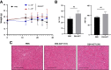 Figure 4. Administration of Delta-24-ACT presents a safe toxicity profile. A, Mice were treated intratibially with mock (PBS) or Delta-24-ACT one or three times at the indicated doses. Mice from the different groups were weighed every 3 to 4 days until the end of the treatment period (25 days). The data are shown as the median ± SD for each group at each time point. B, Evaluation of biochemical parameters related to hepatic toxicity after intratumoral injection of Delta-24-ACT. Mice were treated with mock or virus, and serum samples were collected 3 days later. Several parameters, including ALT (U/L) and AST (U/L) levels, were measured to monitor hepatic injury. C, Histologic analysis of the livers of mice bearing orthotopic murine osteosarcoma tumors and treated locally with 108 PFU Delta-24-ACT one or three times. Representative micrographs of H&E–stained (magnification, 100 μm) livers of mice from the indicated groups are shown. The images show no viral presence in mouse livers and no signs of hepatotoxicity.