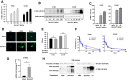 Figure 1. Characterization of Delta-24-ACT in osteosarcoma cell lines. A, Expression of 4-1BBL mRNA after infection with Delta-24-ACT at the indicated MOIs in K7M2 and 531MII cells (N = 3). B, Assessment of 4-1BBL protein expression by Western blot analysis. Cells were infected with Delta-24-ACT at the indicated MOIs, and 48 hours later, whole-cell lysates were collected. Grb2 was used as the protein loading control, and recombinant 4-1BBL protein was used as the positive control. C, Flow cytometric quantification of 4-1BBL expression in the membrane of murine (K7M2) and human (531MII) osteosarcoma cells infected with Delta-24-ACT at the indicated MOIs. D, Representative fluorescence micrographs of K7M2 cells 24 hours after infection with Delta-24-ACT or mock infection. 4-1BBL at the cell surface was detected by immunofluorescence (green). Samples were counterstained with DAPI (blue). E, Replication of Delta-24-ACT in murine K7M2 and human 531MII osteosarcoma cells. Cells were infected, and Delta-24-ACT replication was determined after 72 hours. The results are expressed as the mean viral titers ± SDs (N = 3). F, Oncolytic effect of Delta-24-ACT and Delta-24-RGD on murine and human osteosarcoma cells. To quantify the oncolytic effect of the viruses, cells were infected at the indicated MOIs, and five days later, viability was evaluated by MTS assays. The values indicate the percentages of viable cells in infected cultures compared with those in noninfected cultures (mean ± SD). G, In vivo evaluation of 4-1BBL mRNA expression in orthotopic human osteosarcoma tumors. H, Assessment of 4-1BBL, E1A, and fiber expression in vivo in orthotopic human osteosarcoma tumors by Western blot analysis. A representative blot is shown.