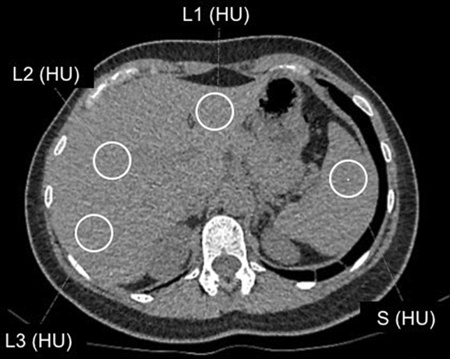 Fig. 1