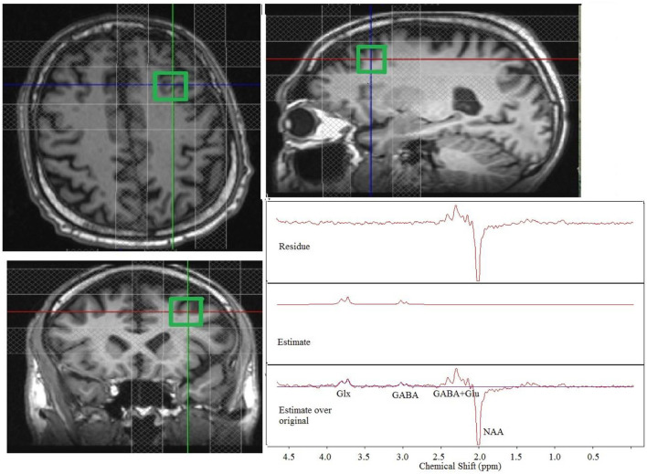 Figure 1