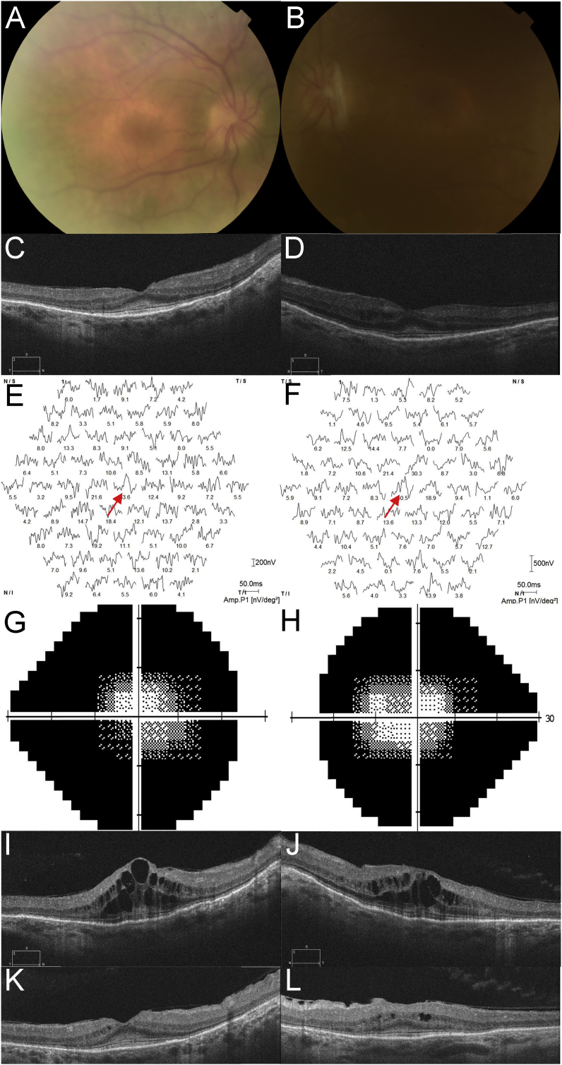 Fig. 2