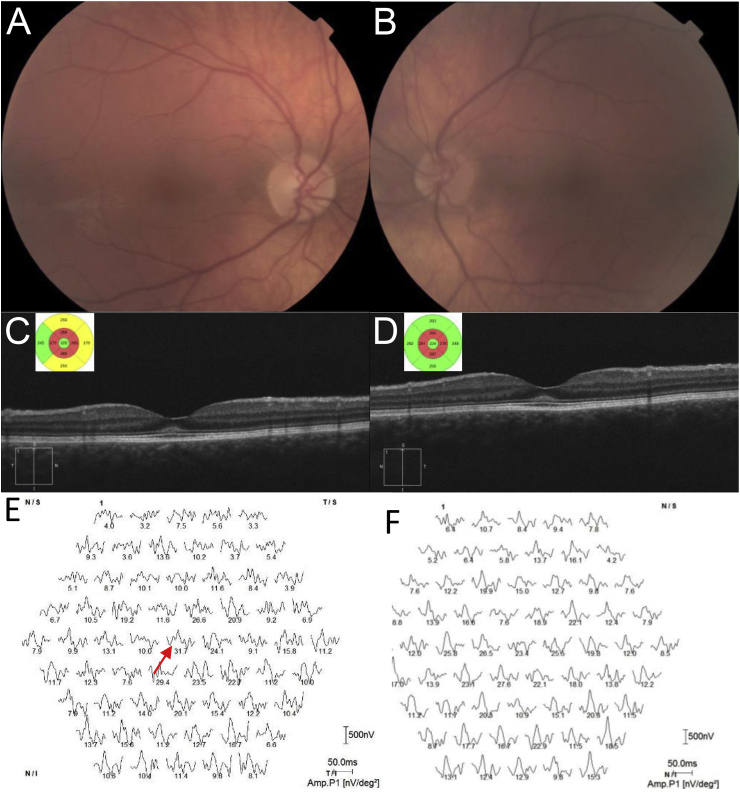 Fig. 1