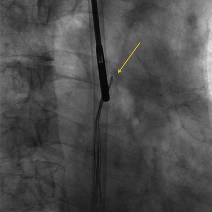 graphic file with name fx1.jpg