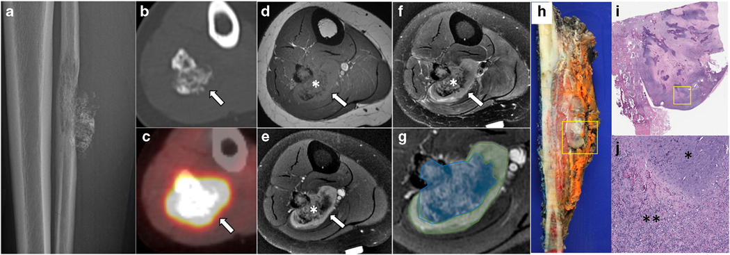 Fig. 1 –