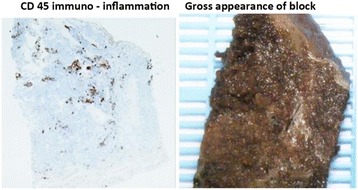 Fig. 5 (abstract P50).