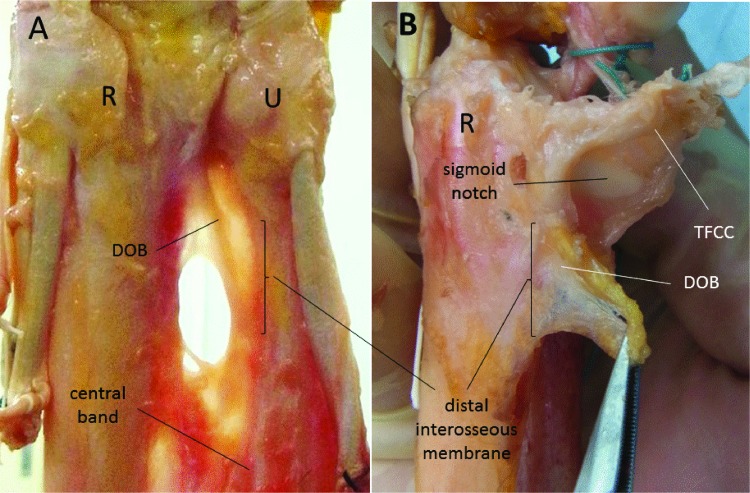 Fig. 1a,b