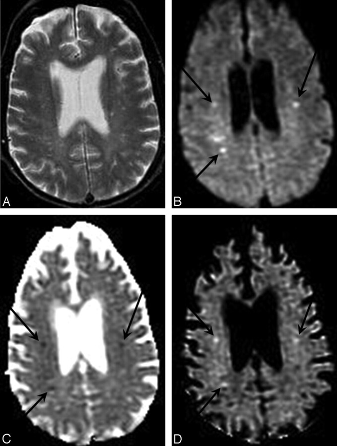 Fig 2.