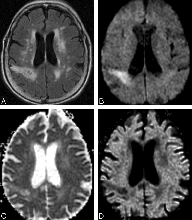 Fig 3.