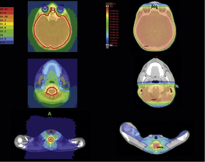 Fig. 4