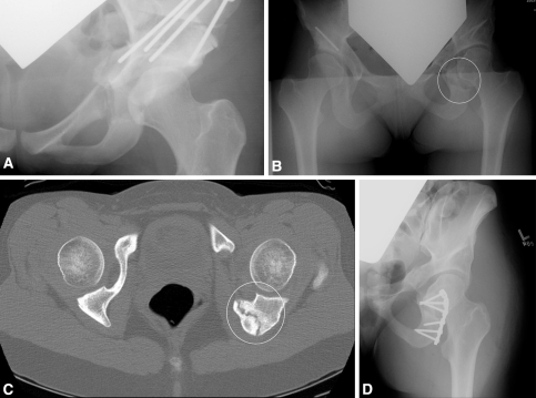 Fig. 2A–D