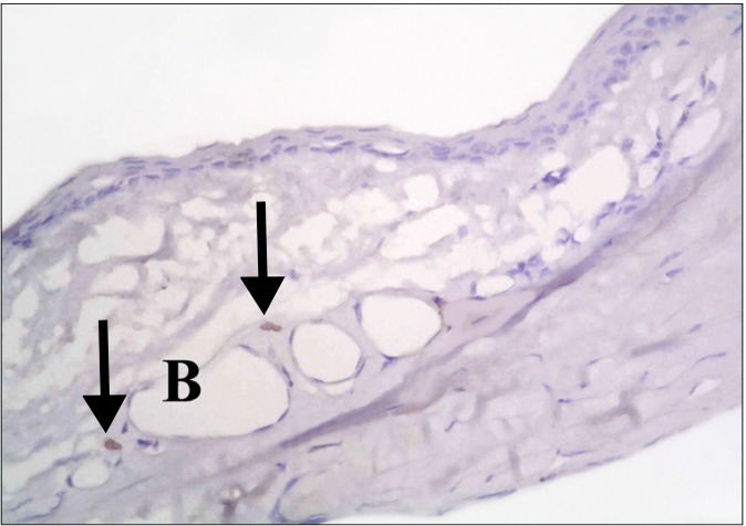 Fig. 11.