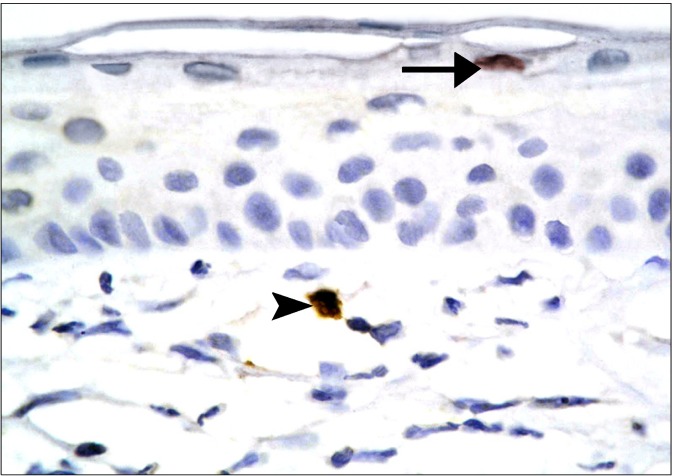 Fig. 14.