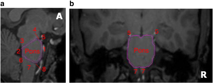 Fig. 1