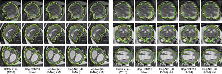 Fig. 9