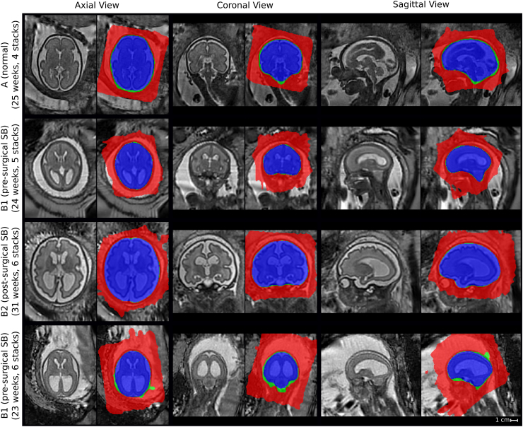 Figure 13