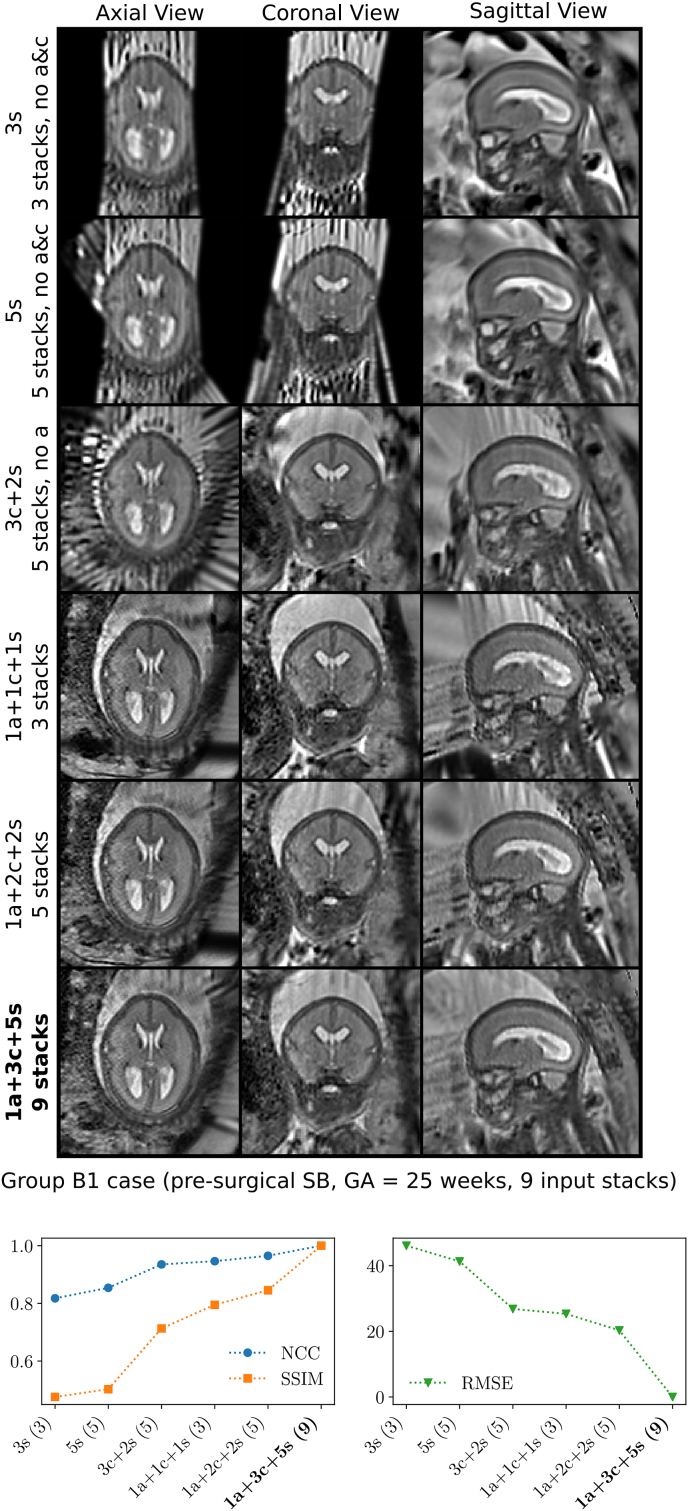 Fig. 21