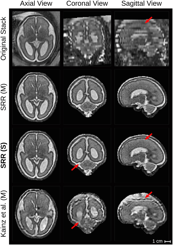 Fig. 19