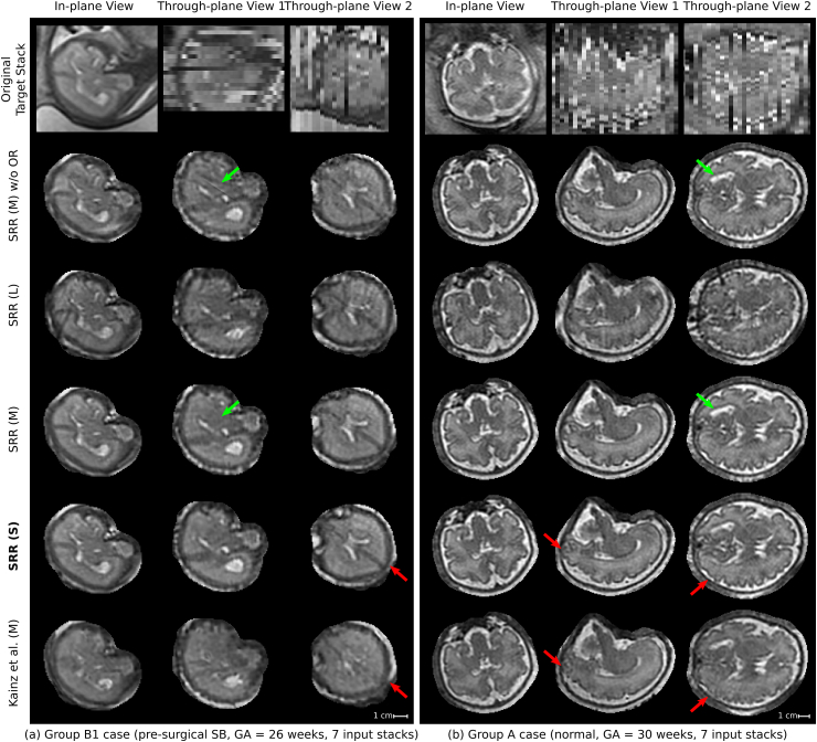 Fig. 14