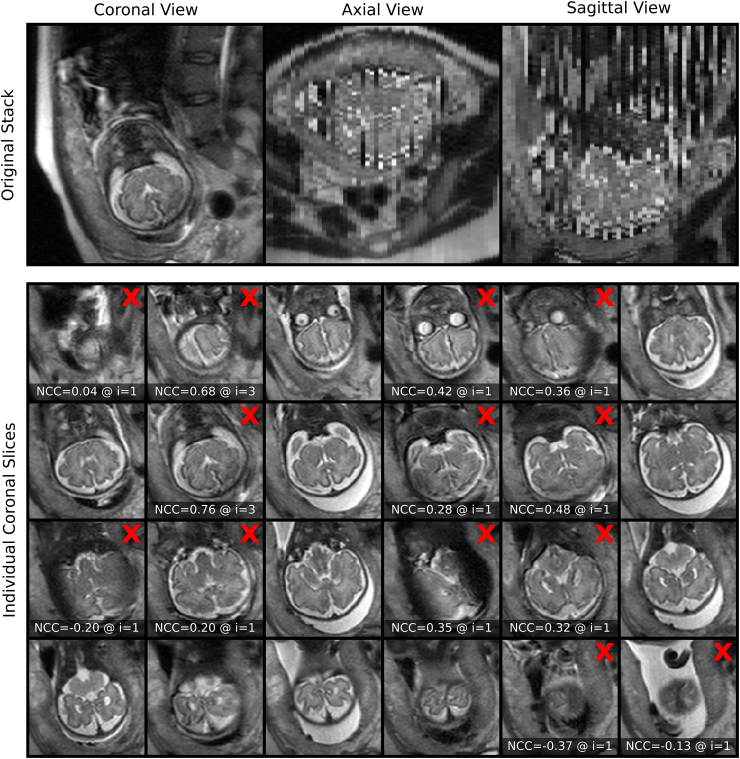 Fig. 16