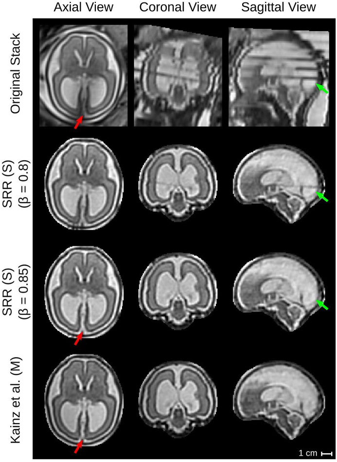 Fig. 20