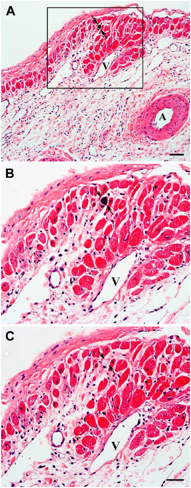 Figure 11.