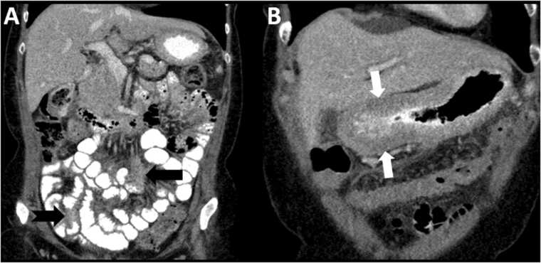 Fig. 10