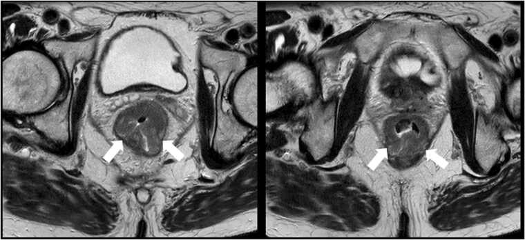 Fig. 8