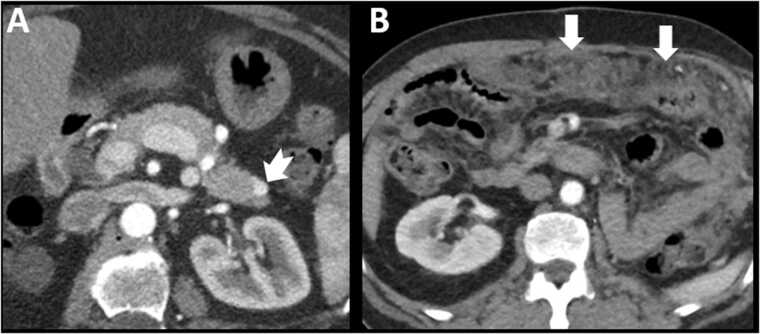 Fig. 13