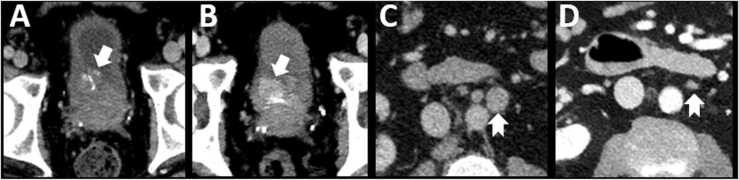 Fig. 12