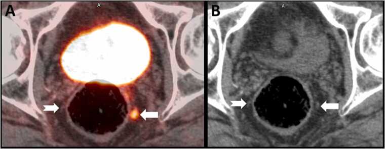 Fig. 11