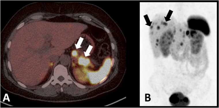 Fig. 6