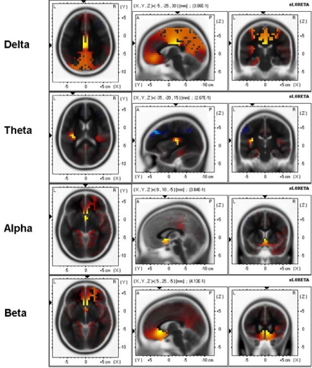 Fig. (5)