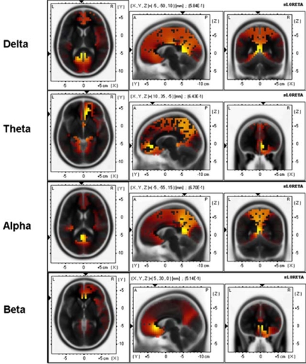 Fig. (6)